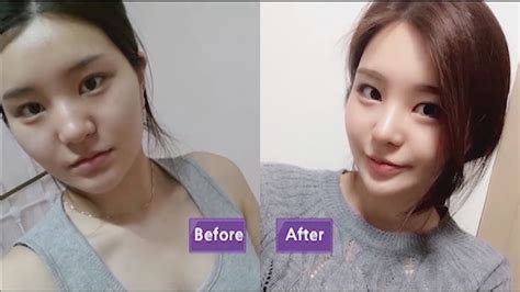 best korean cosmetic surgery clinic.